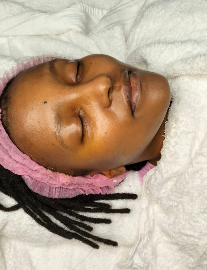 Before Treatment